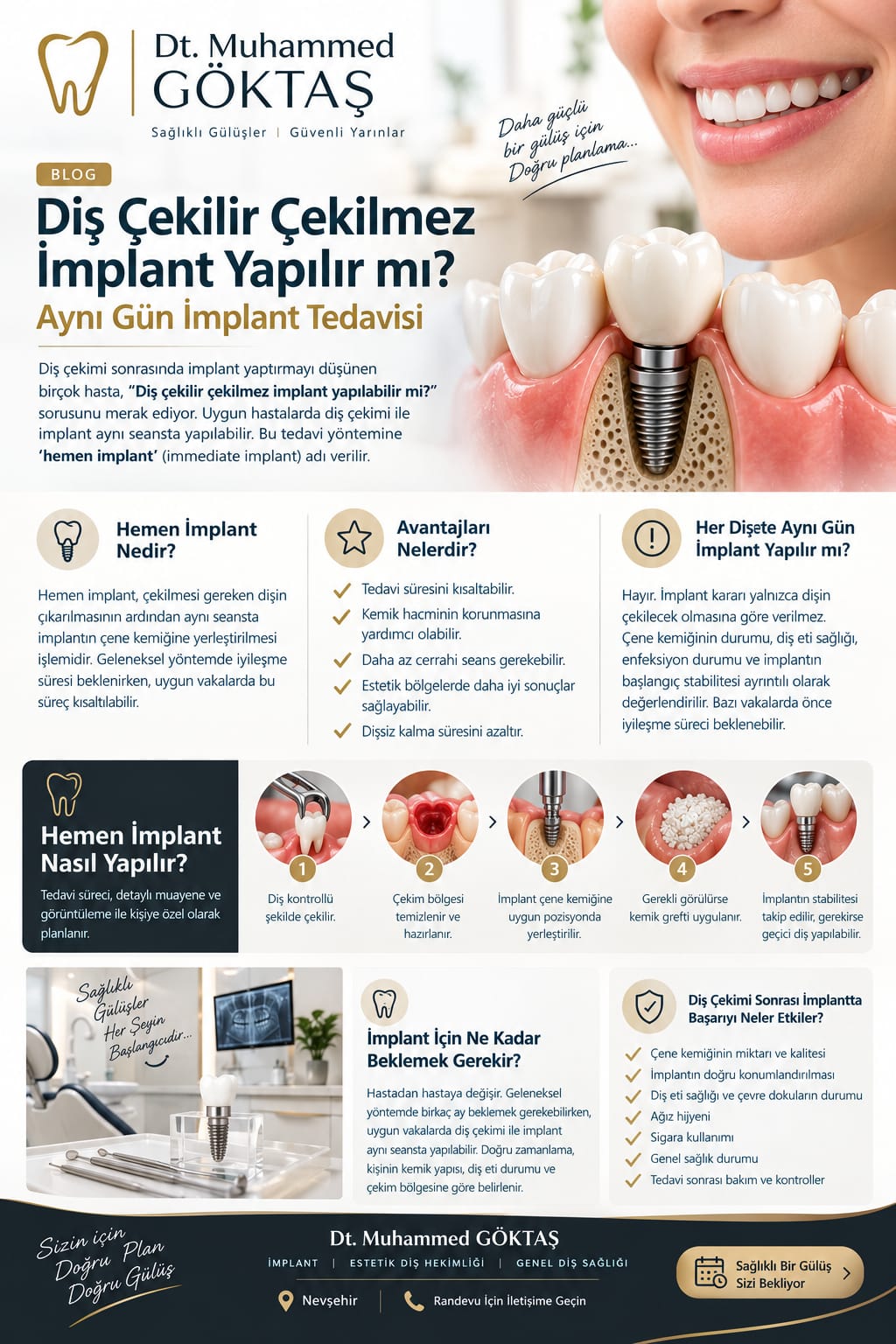 Diş çekimiyle aynı seansta implant uygulamasının aşamalarını anlatan bilgilendirme görseli