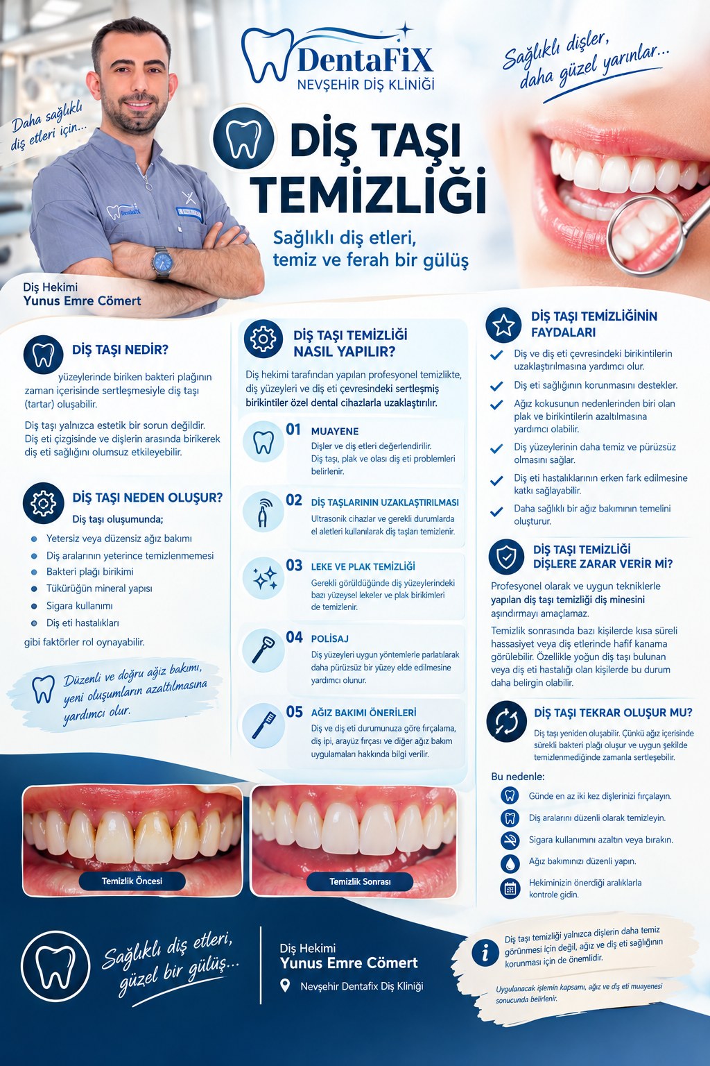 Dt. Yunus Emre Cömert’in diş taşı temizliği ve bakım önerileri