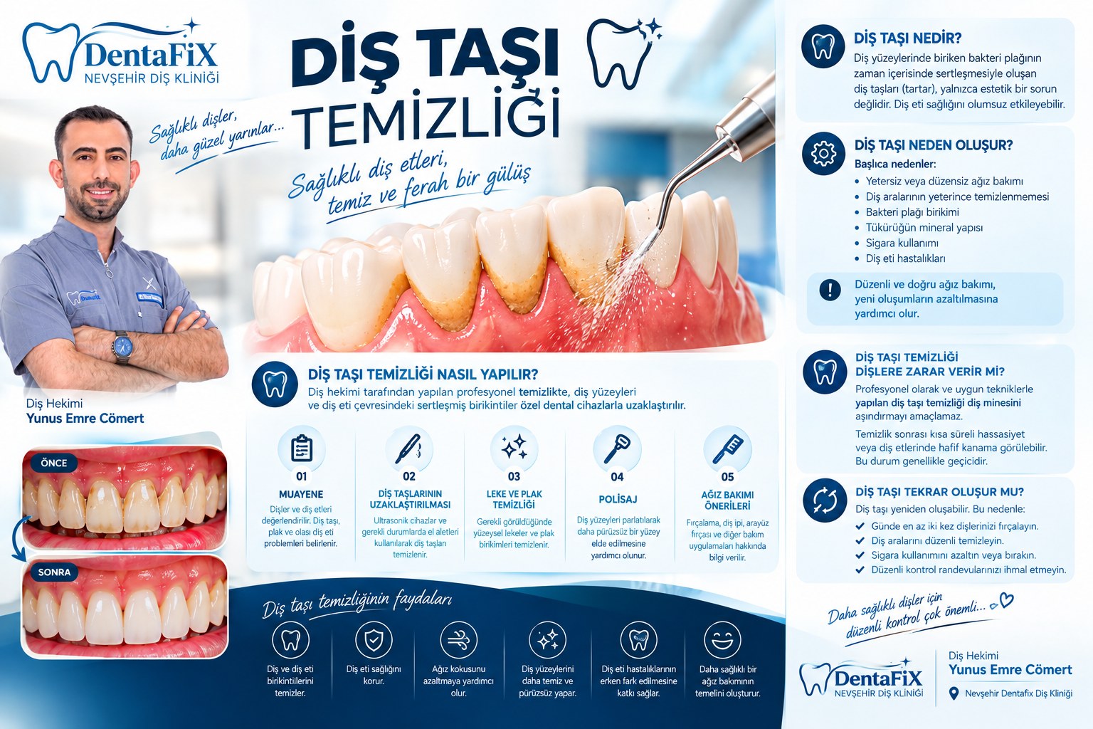 Diş Taşı Temizliği: Sağlıklı Diş Etleri, Temiz ve Ferah Bir Gülüş