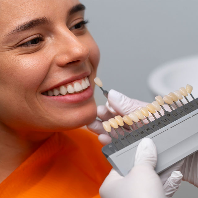 Hollywood Smile Uygulama Süreci