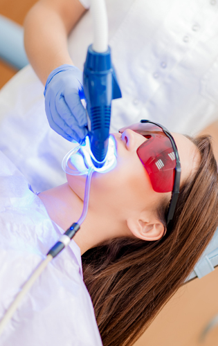 Was ist Zahnaufhellung?