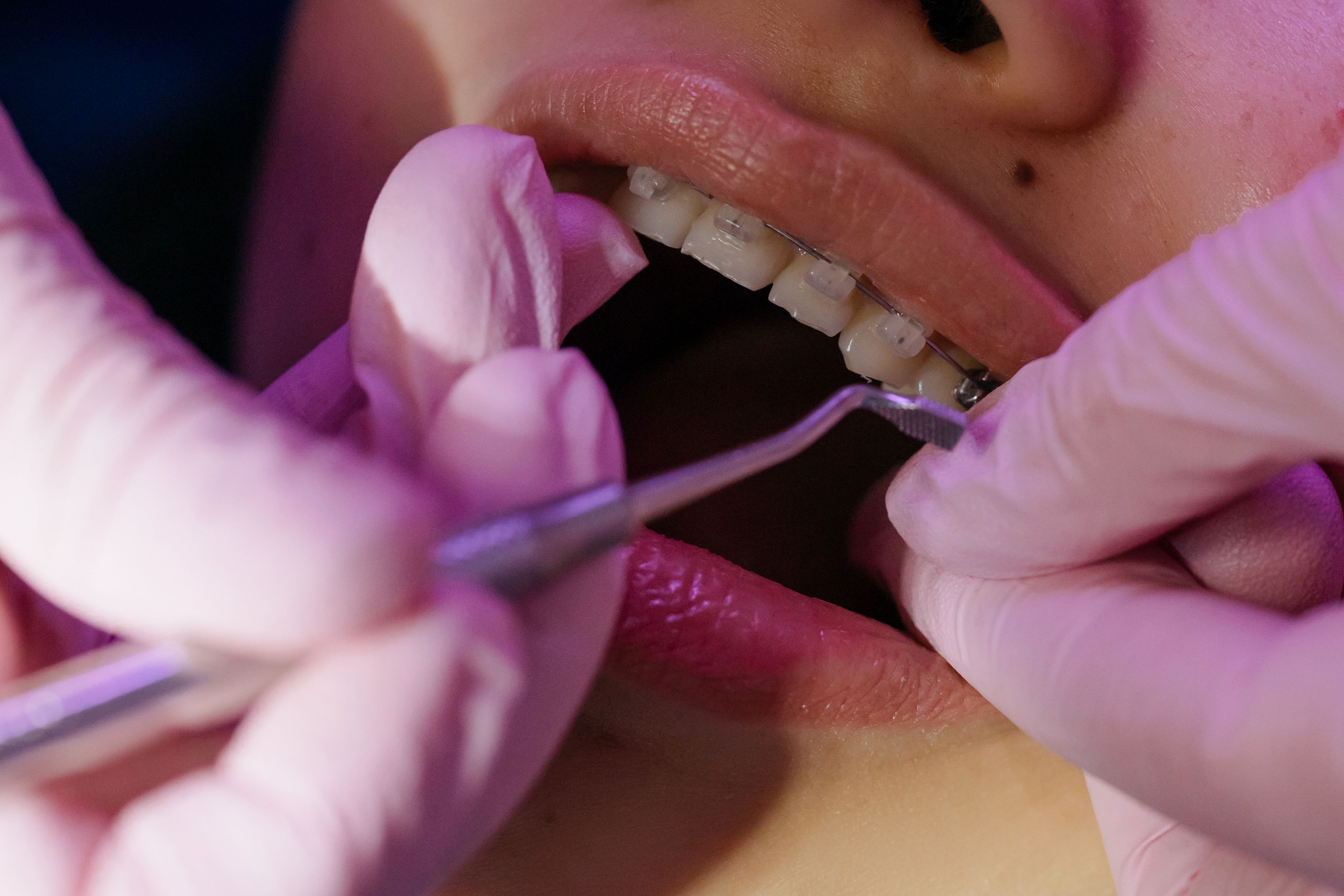 Diş Telleri 3D dental render
