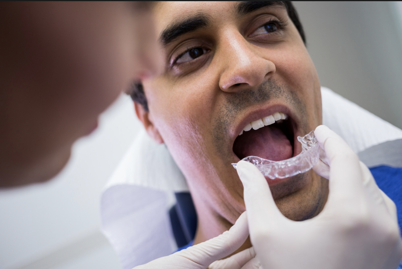 Şeffaf Plaklar 3D dental render