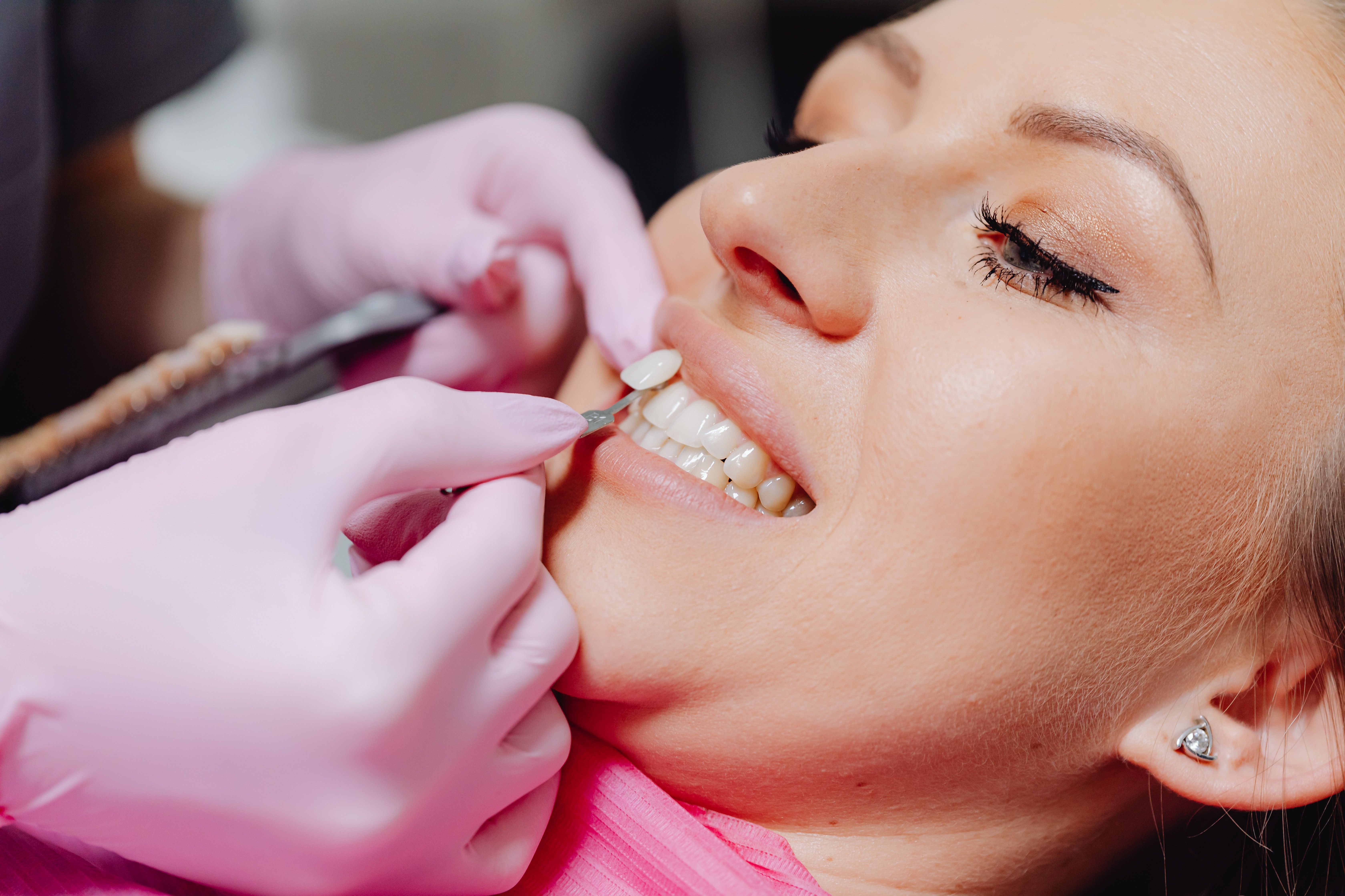 Lamina 3D dental render